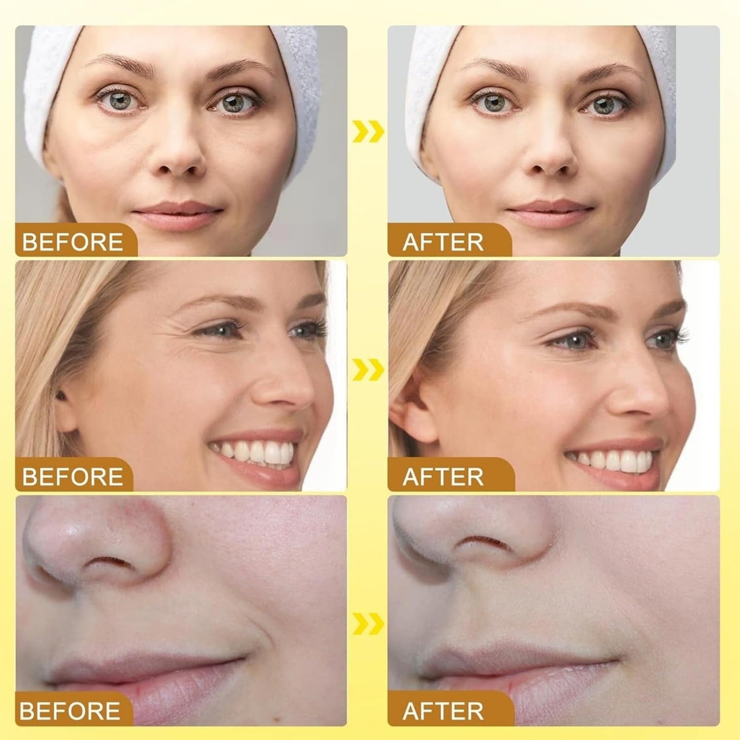 Botox Bee Venom Wrinkle Cream in Pakistan | Anti-Aging & Collagen Boosting Moisturizer
